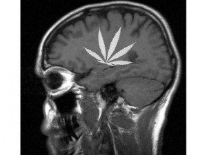 medical-marijuana-brain-300x225