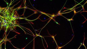 An image of neural stem cells.